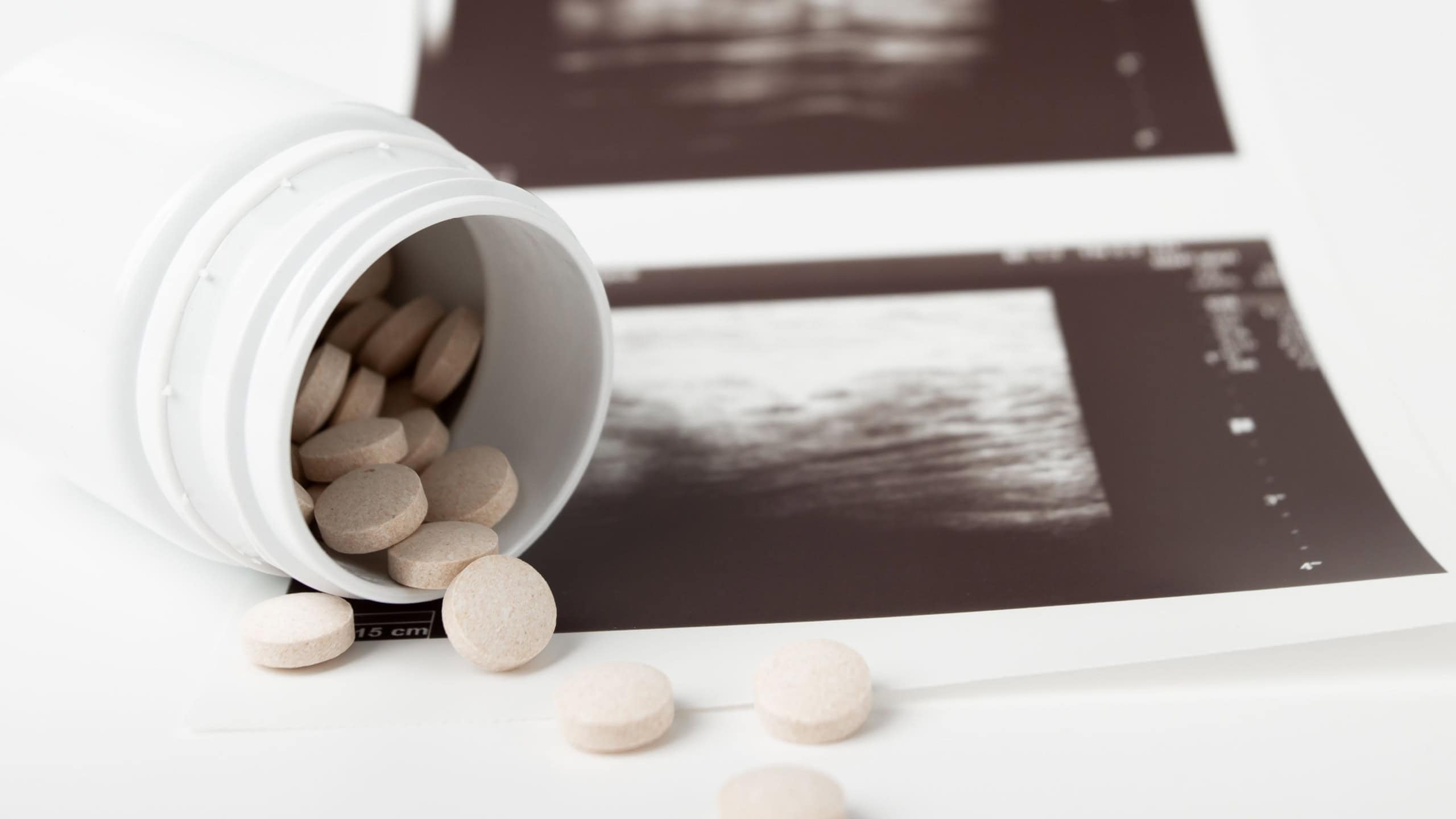 Abortion tablets, pregnancy termination, pharmaceutical intervention, healthcare option