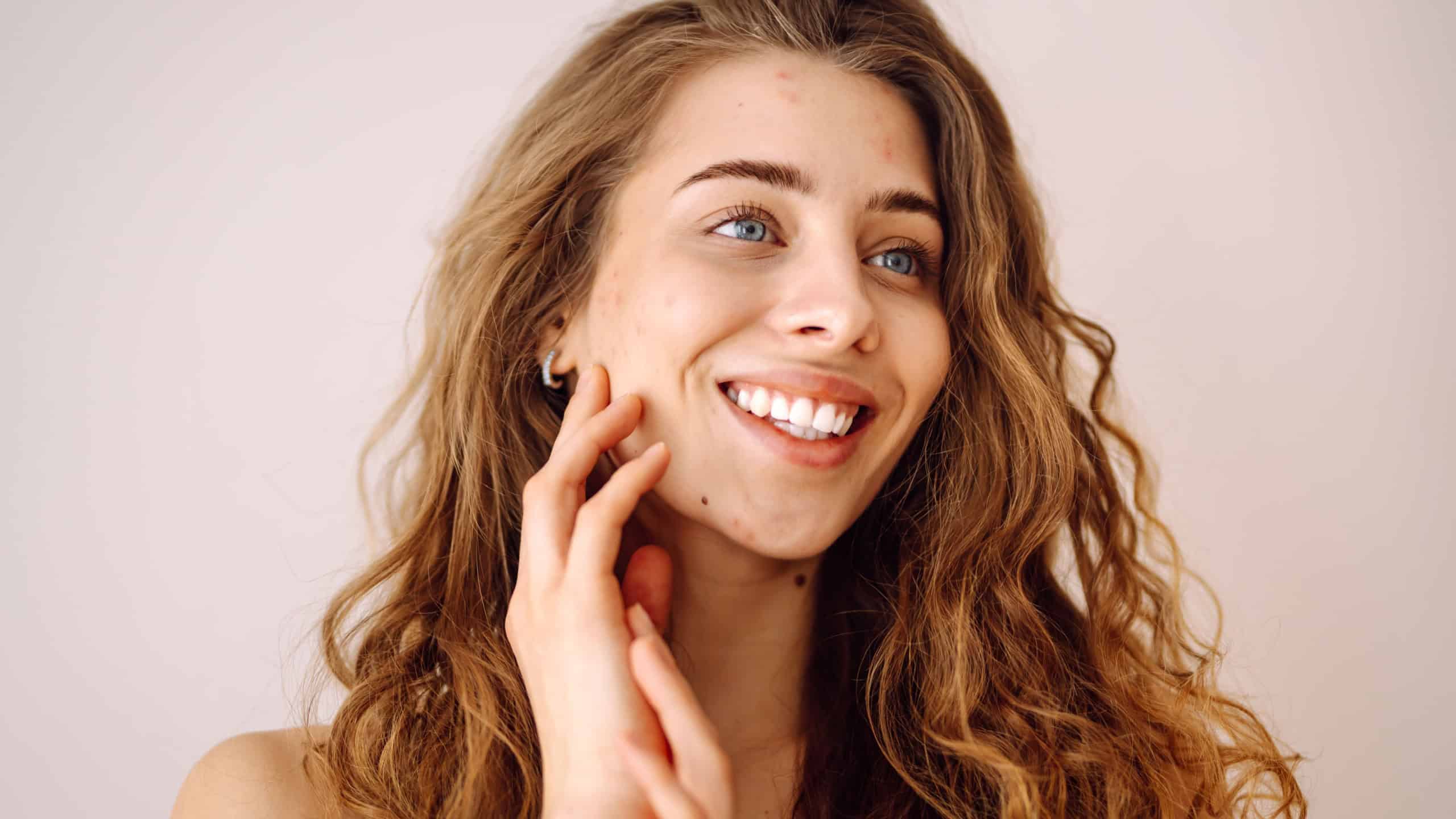 Woman no make up with red spots on her face. Health problem, skin diseases. Medicine and cosmetology concept.